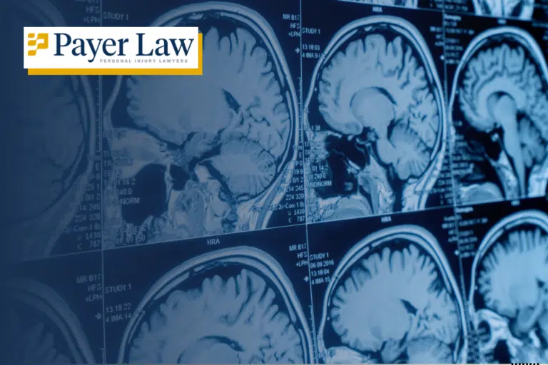 a brain injury victim in Miami gets an x-ray of their brain after an accident